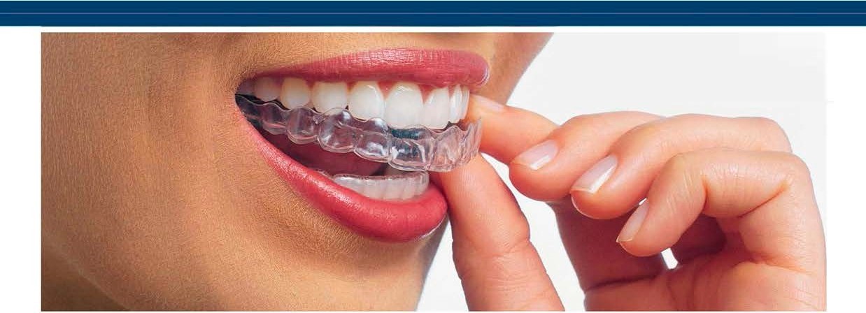 Invisalign