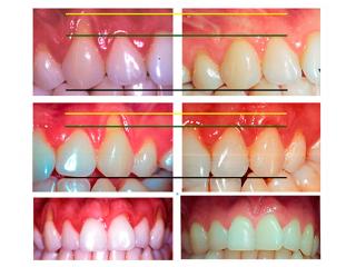 Espec Perio-Bef-Aft2